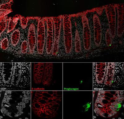 What Is an L-Cell and How Do We Study the Secretory Mechanisms of the L-Cell?